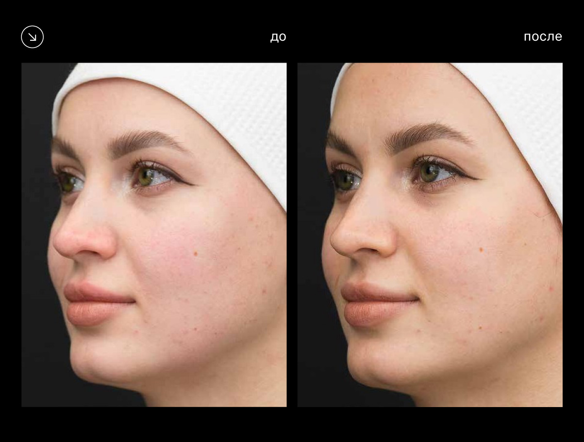 Эффективность аппарата