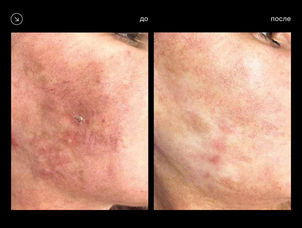 Эффективность аппарата