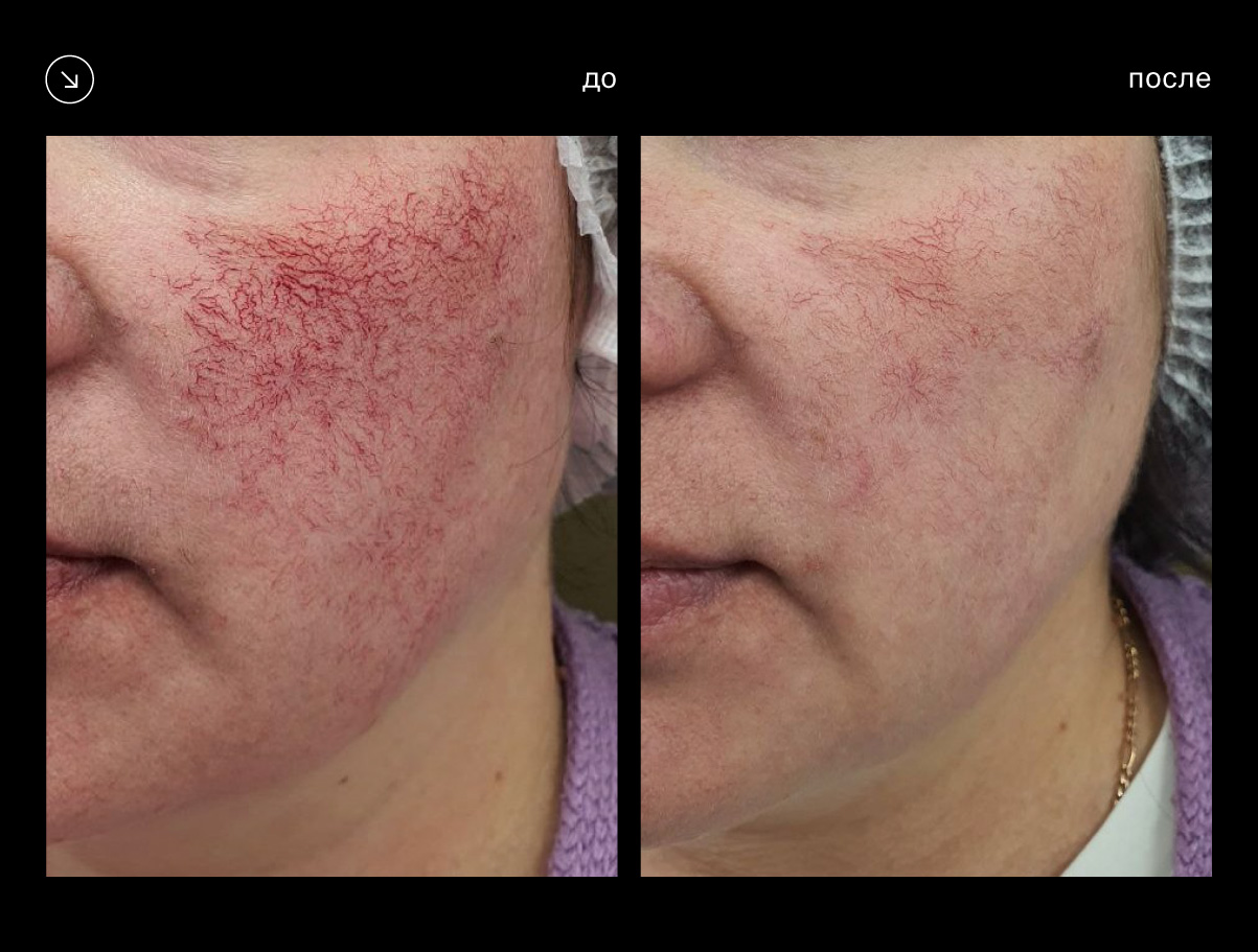 Эффективность аппарата