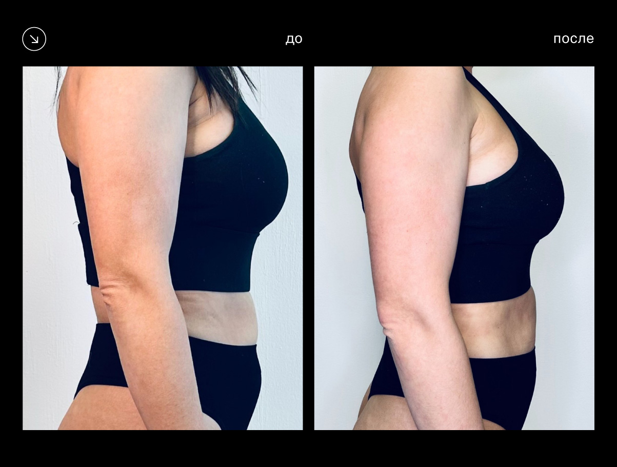 Эффективность аппарата