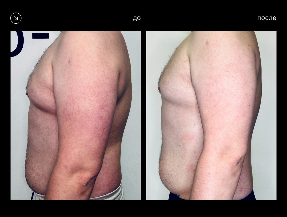 Эффективность аппарата