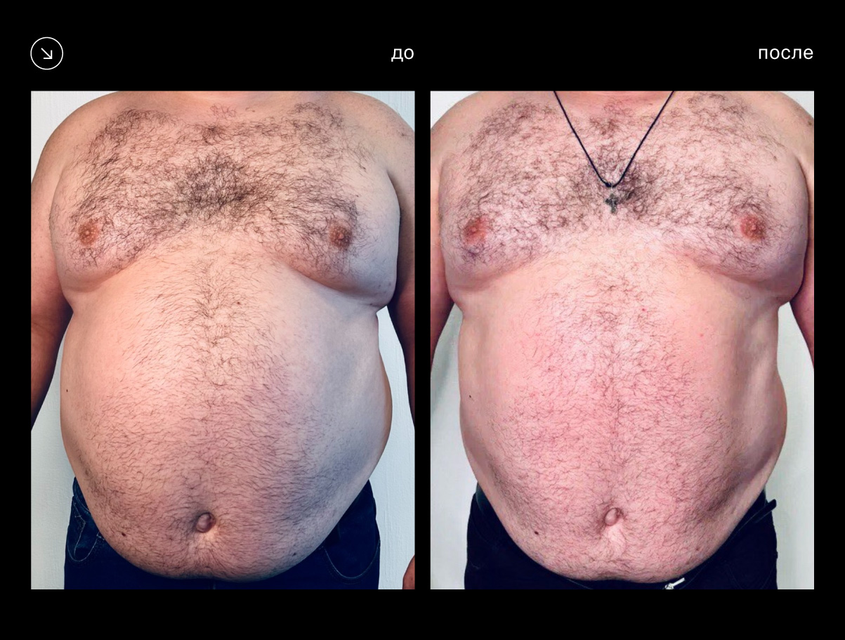 Эффективность аппарата