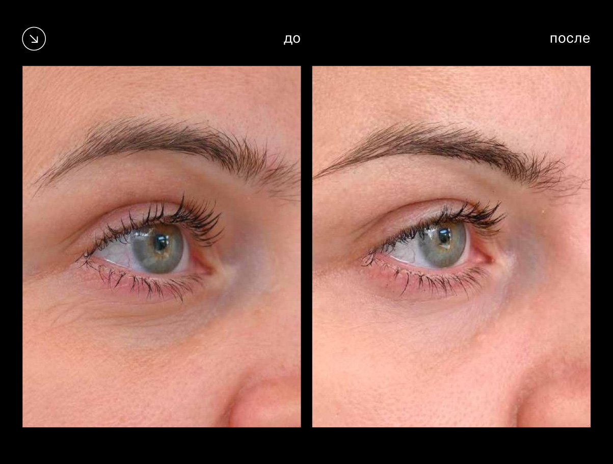 Эффективность аппарата