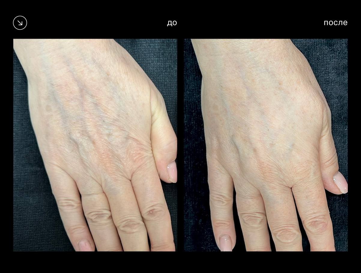 Эффективность аппарата