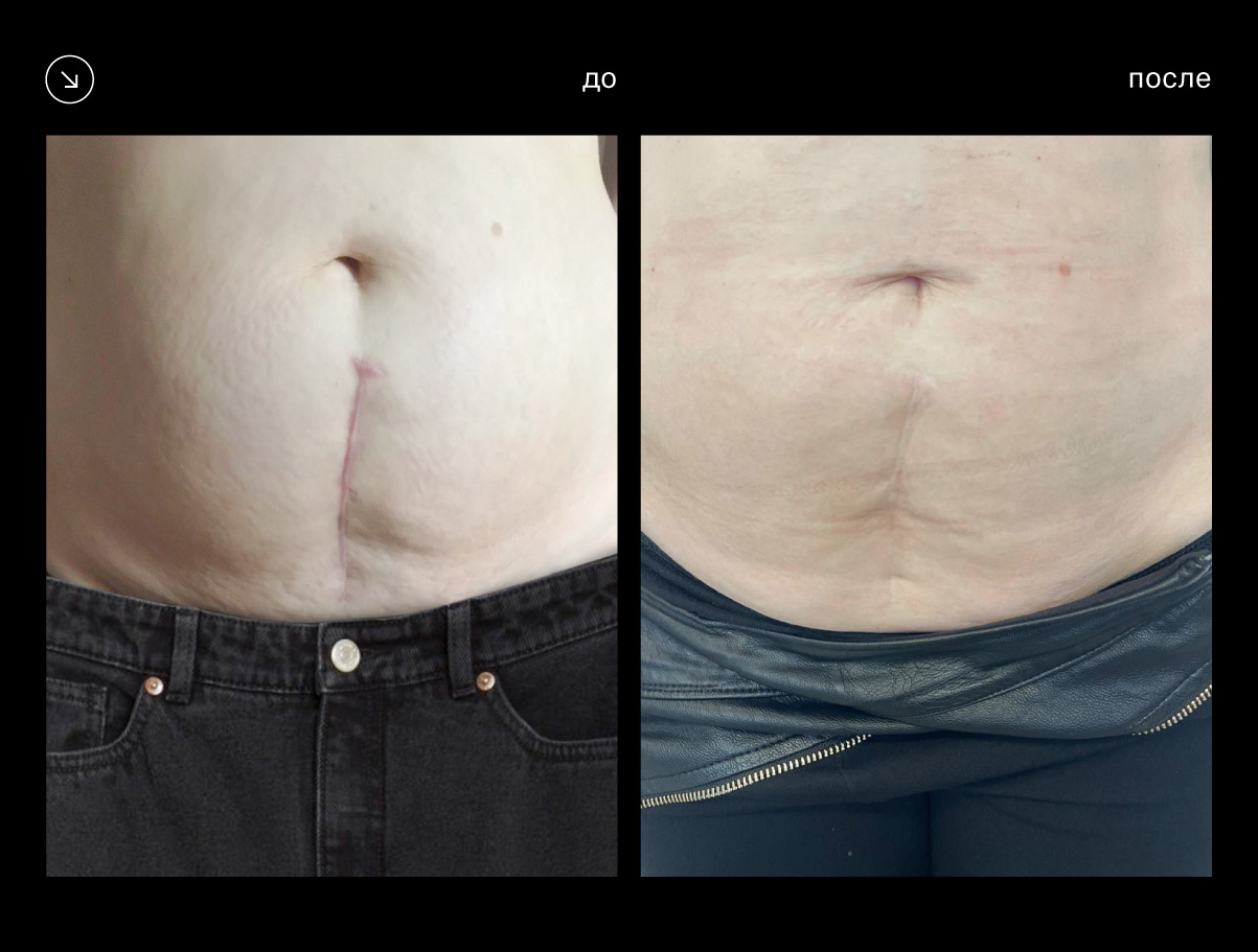 Эффективность аппарата