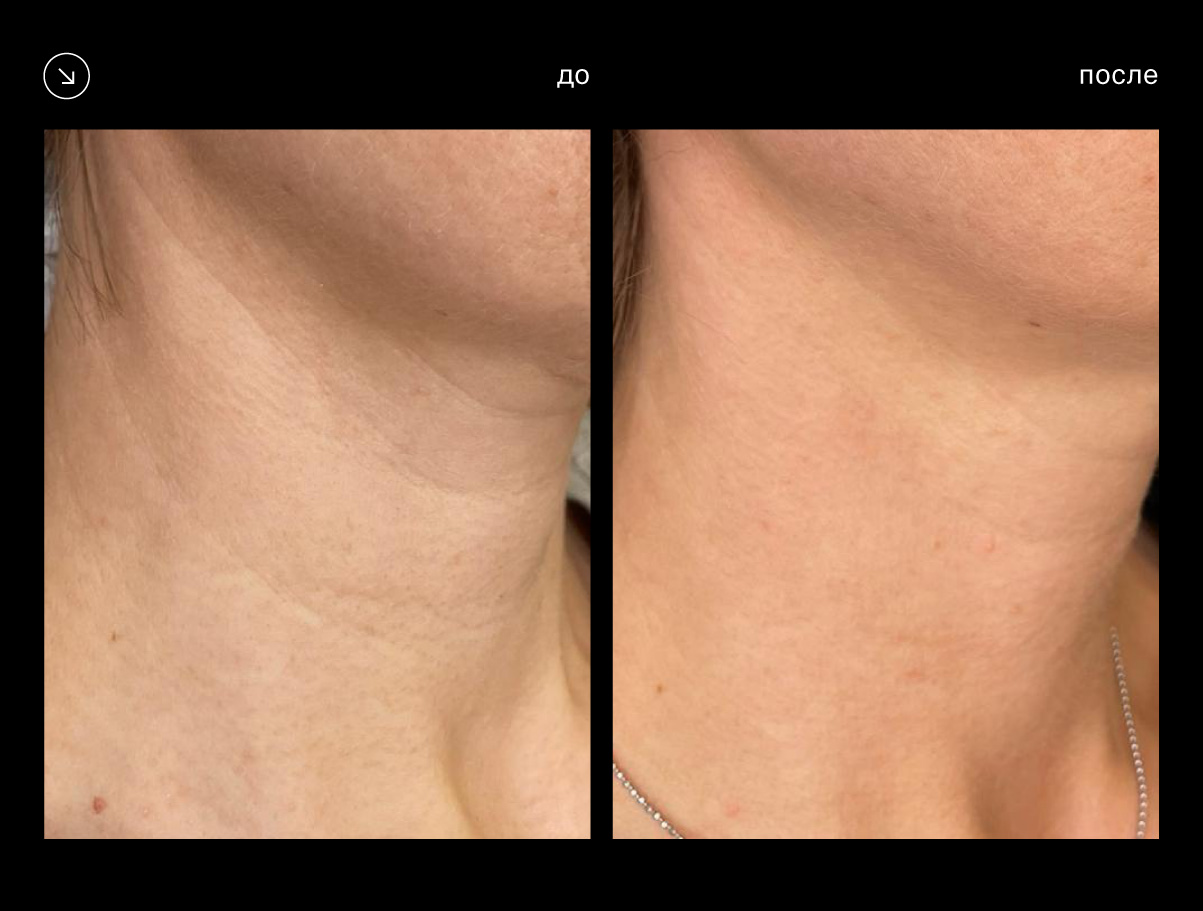 Эффективность аппарата