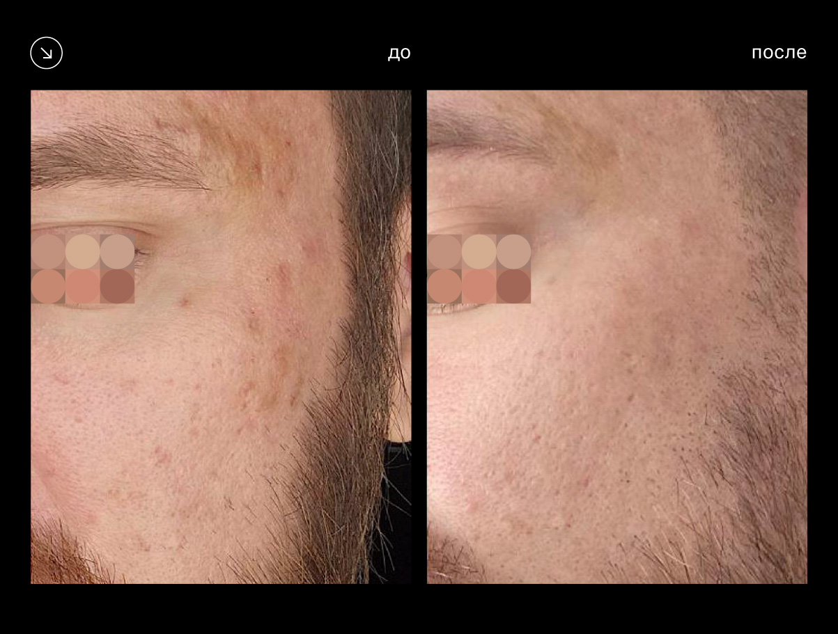 Эффективность аппарата